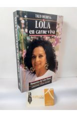 LOLA EN, CARNE VIVA. MEMORIAS DE LOLA FLORES